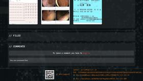 Screen